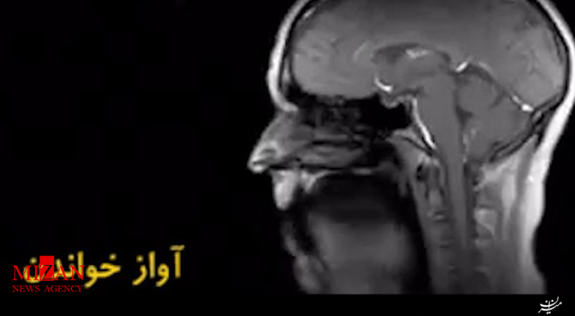 MRI دیدنی از حالات مختلف بدن انسان! +فیلم