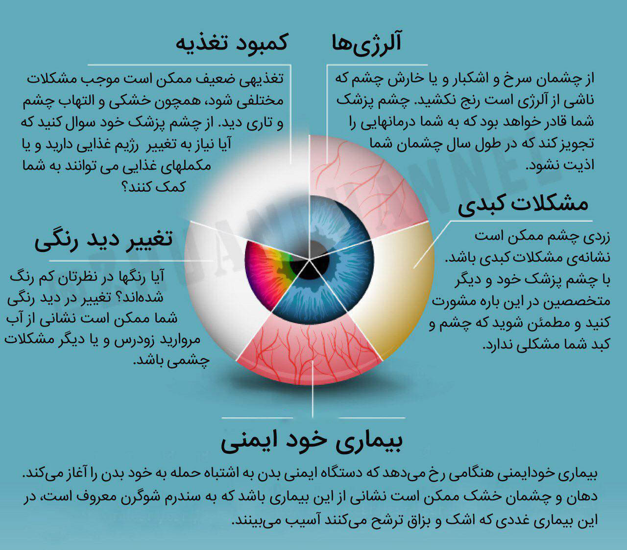 چشمهایتان کدام بیماریها را لو میدهند؟! +اینفوگرافی چشمهایتان کدام بیماریها را لو میدهند؟! +اینفوگرافی