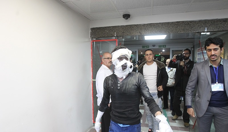 تصاویر آرشیوی از مصدومان حوادث چهارشنبه سوری تصاویر آرشیوی از مصدومان حوادث چهارشنبه سوری
