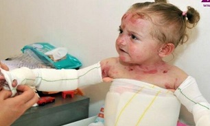 «تحریم» دردی جدید برای «پروانه‌ای‌ها»