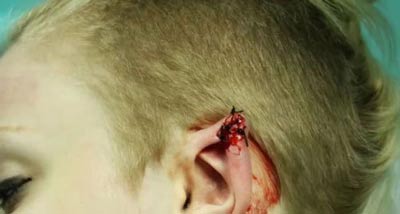 جراحی گوش این دختر برای شبیه شدن به گوش گرگ +عکس