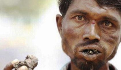 اعتیاد عجیب و غریب یک مرد هندی +عکس