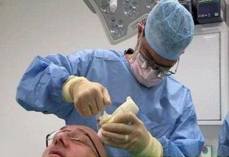 بدشانسی مرد کچل برای جراحی موهایش +عکس بدشانسی مرد کچل برای جراحی موهایش +عکس