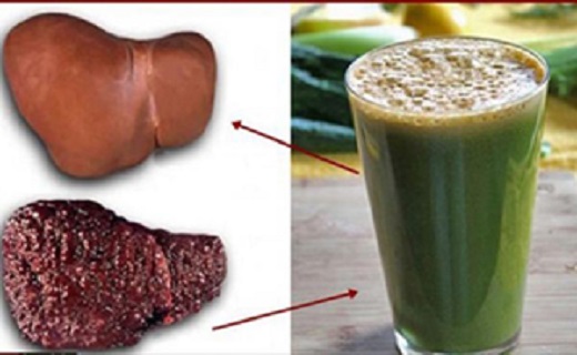شوینده ای برای کبد چرب + عکس