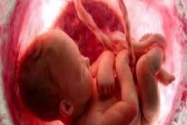 کاهش ۱۹ درصدی پر ونده‌های سقط درمانی در سال ۹۸