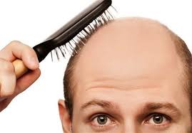 تاثیر استرس کرونایی بر ریزش مو