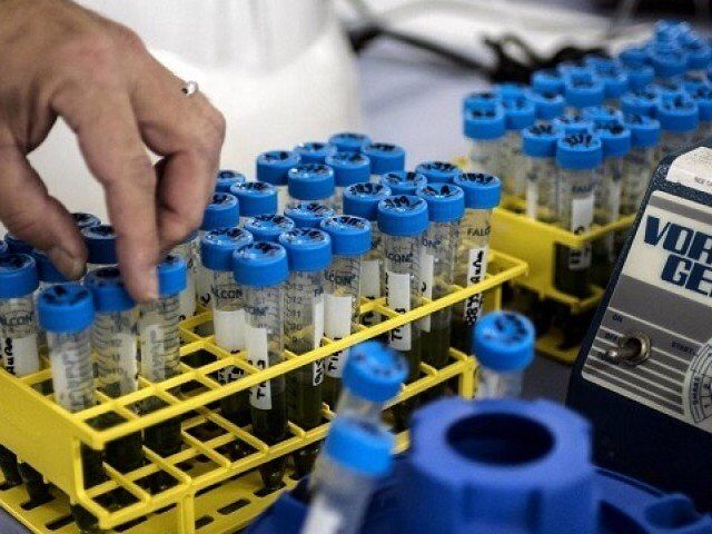 موفقیت «پلاسما درمانی» بیماران کرونایی در پاکستان