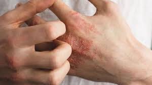 آیا کرونا باعث چین و چروک صورت می شود؟