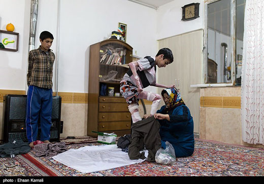 درد و رنج انسان های پروانه ای + تصاویر