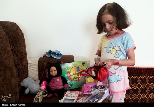 درد و رنج انسان های پروانه ای + تصاویر