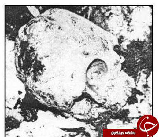 جمجمه نادر شاه افشار بعد از نبش قبر + عکس جمجمه نادر شاه افشار بعد از نبش قبر + عکس