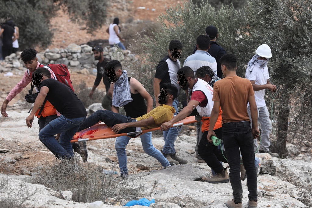 شهادت نوجوان فلسطینی/ مجروح شدن ۳۲۰ نفر در جنوب نابلس شهادت نوجوان فلسطینی/ مجروح شدن ۳۲۰ نفر در جنوب نابلس
