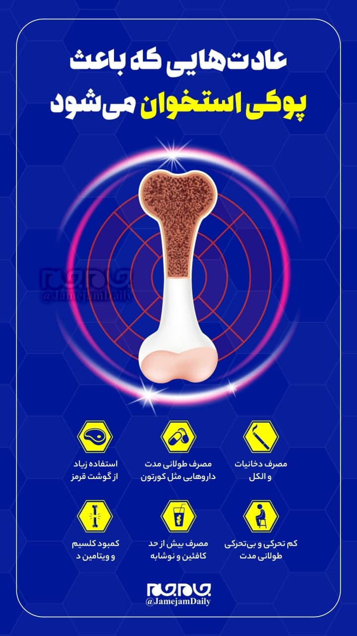 عادت‌هایی که باعث پوکی استخوان می‌شود