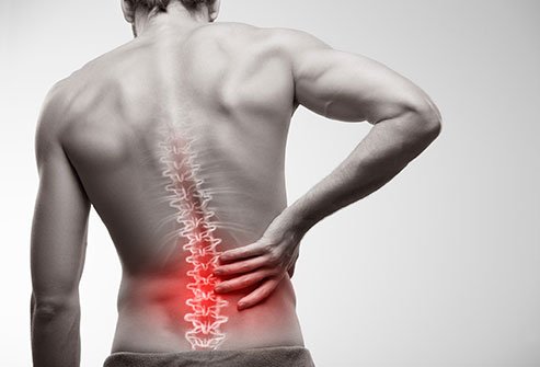 کدام افراد دچار بیرون زدگی دیسک کمر می‌شوند؟