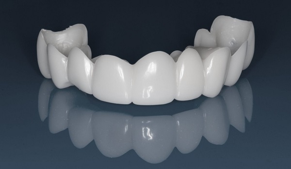 چطور لمینت متحرک دندان خود را نصب کنیم؟ +مزایا و معایب آن چطور لمینت متحرک دندان خود را نصب کنیم؟ +مزایا و معایب آن