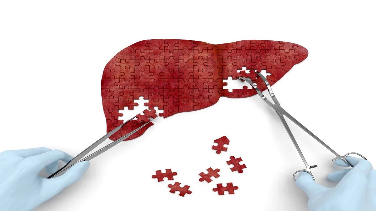 راه های تشخیص آزمایشگاهی بیماریهای کبدی راه های تشخیص آزمایشگاهی بیماریهای کبدی