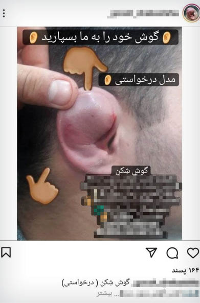 شکستن و پلمب کردن گوش تضمینی بدون درد و خونریزی! شکستن و پلمب کردن گوش تضمینی بدون درد و خونریزی!