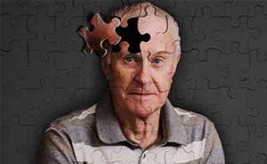 5 دلیل عجیب بیماری آلزایمر 5 دلیل عجیب بیماری آلزایمر
