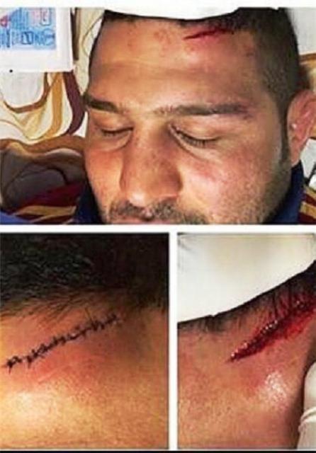 پلنگ‌ جویبار در خانه کشتی زخمی شد + عکس