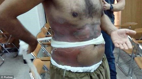 داعش از گاز خردل در عراق استفاده کرده است