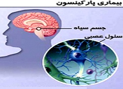 موفقیت ژن‌درمانی در بیماری پارکینسون