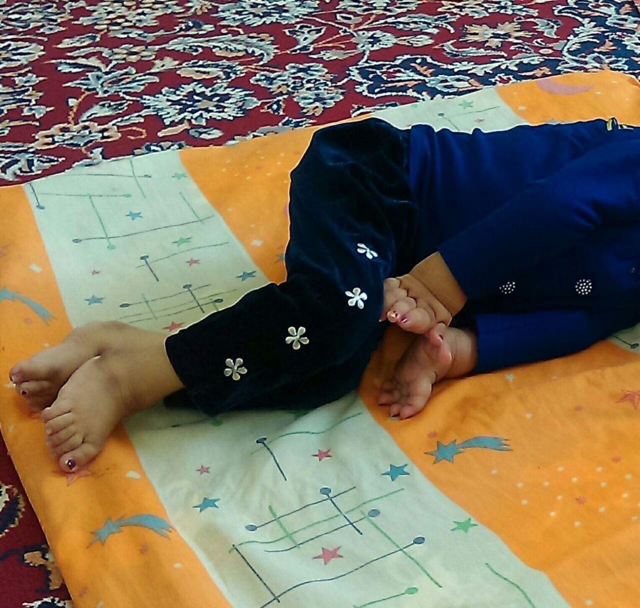 مبتلا به یک بیماری ژنتیکی نادر +تصاویر مبتلا به یک بیماری ژنتیکی نادر +تصاویر