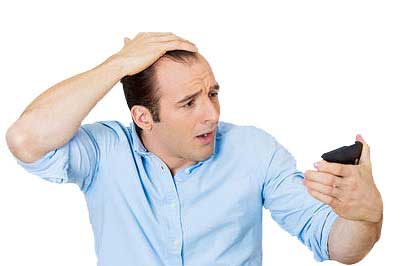 چرا موهای مردان بیشتر میریزد؟