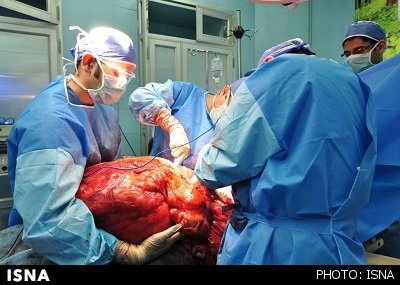 خارج کردن توده 33 کیلویی از شکم یک مشهدی + عکس