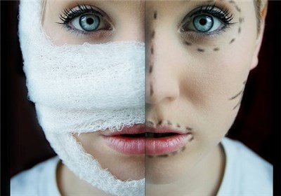 تب جراحی زیبایی و آرایش بر جان جوانان ایرانی تب جراحی زیبایی و آرایش بر جان جوانان ایرانی