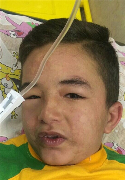 ماجرای شوک کودک ۸ ساله پس از تزریق پنی‌سیلین+عکس