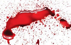 شوهر آمریکایی انگشت نو عروسش را با دندان قطع کرد