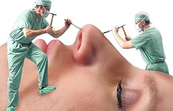 جراحی زیبایی از هالیوود تا ایران/ چرا جراحی‌های زیبایی اوج گرفتند؟