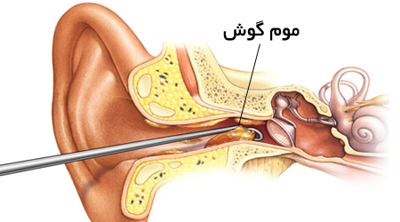 الهام از موم گوش برای فیلتر تجهیزات روباتیک