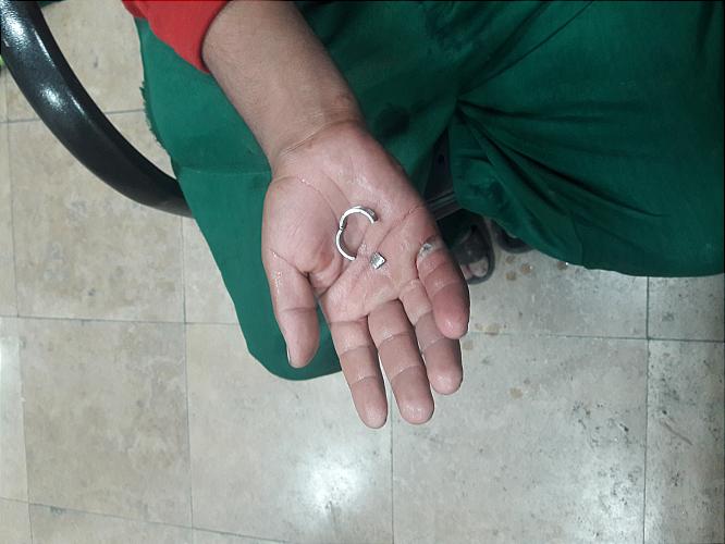 دردسر انگشتر تنگ برای مرد جوان