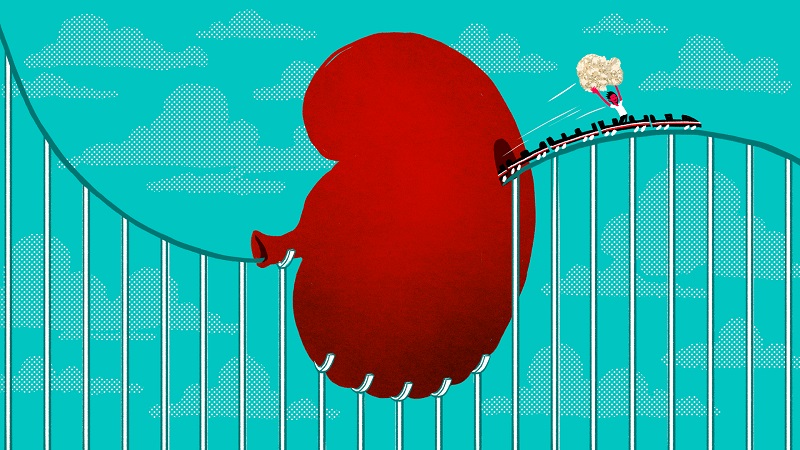 برای دفع سنگ کلیه چه کنیم؟