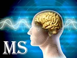 همه چیز درباره اسپاسم عضلات در بیماران مبتلا به MS