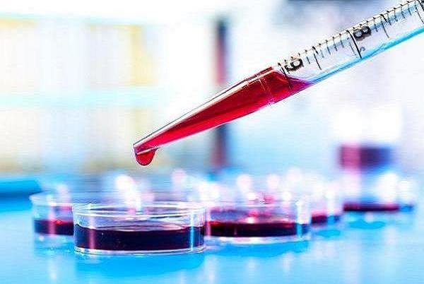 هشدار! آلودگی هوا به DNA کودکان آسیب میرساند/ جلوی آیینه بنشینید و غذا بخورید/ چرا به عدم تحمل لاکتوز مبتلا میشویم؟ / مضرات هندوانه! هشدار! آلودگی هوا به DNA کودکان آسیب میرساند/ جلوی آیینه بنشینید و غذا بخورید/ چرا به عدم تحمل لاکتوز مبتلا میشویم؟ / مضرات هندوانه!