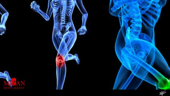 استفاده از استخوان اجساد در جراحی های ارتوپدی