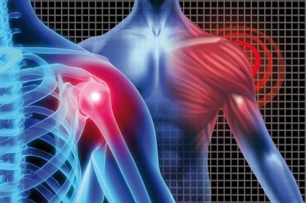 آرتروز شانه را جدی بگیرید