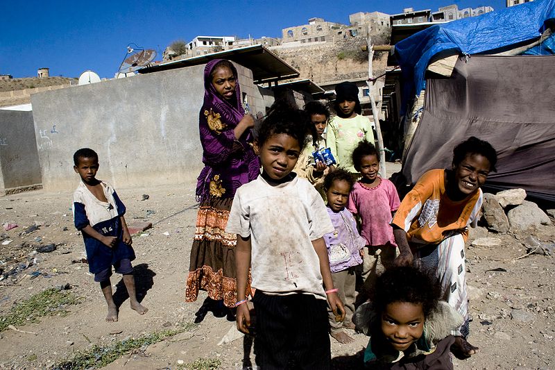 کودکان فراموش شده در جنگ یمن؛حملات بی‎رحمانه عربستان به یمن با پشتیبانی غرب