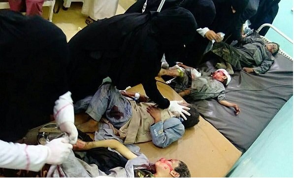 نگاهی به اعمال جنایتکارانه سعودی‌ها در سه سال اخیر / از کشتن ۵ هزار کودک در یمن تا ویران کردن خانه‌های مردم در شرق عربستان / قطعه قطعه کردن یک منتقد، کوچکترین جنایت سعودی‌هاست