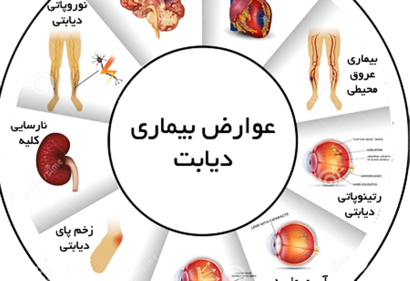 معاینات دوره‌ای چشم، قلب و کلیه بیماران دیابتی لازم است