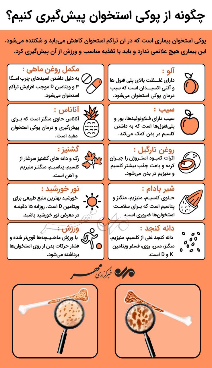 راهکارهایی برای اینکه به پوکی استخوان مبتلا نشوید! + اینفوگرافی