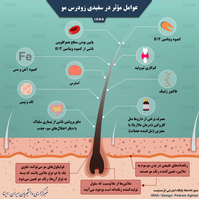 چرا سفیدی زودرس مو به سراغمان می‌آید؟