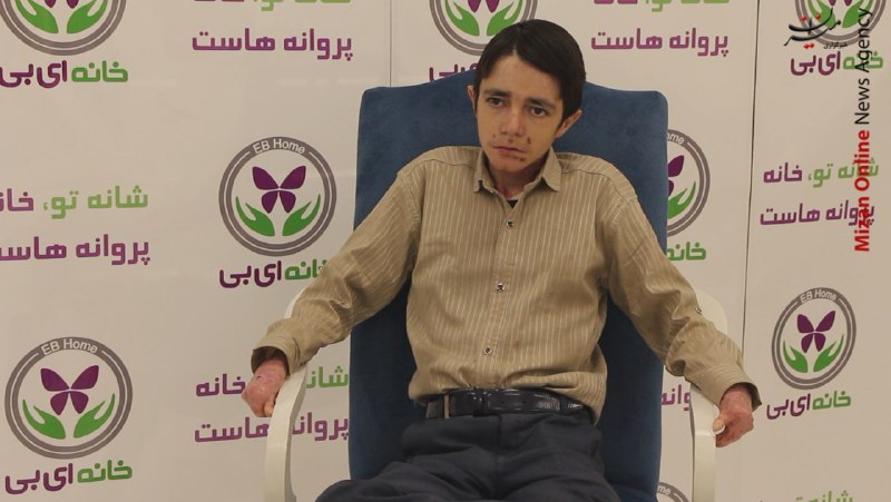 مرگ ۱۵ بیمارای بی به دلیل تحریم پانسمان مپیلکس/اجتناب شرکت سوئدی از در اختیار قرار دادن پانسمان مپیلکس برای مبتلایان بهای بی در ایران مرگ ۱۵ بیمارای بی به دلیل تحریم پانسمان مپیلکس/اجتناب شرکت سوئدی از در اختیار قرار دادن پانسمان مپیلکس برای مبتلایان بهای بی در ایران