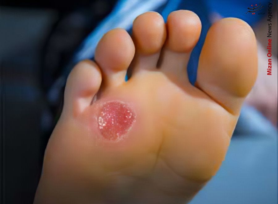 چه کسانی کاندید ابتلا به دیابت هستند؟/نقش ۸۵ درصد استرس در ابتلا به مرض قند/بسته بندی خارجی برخی داروهای ایرانی چه کسانی کاندید ابتلا به دیابت هستند؟/نقش ۸۵ درصد استرس در ابتلا به مرض قند/بسته بندی خارجی برخی داروهای ایرانی
