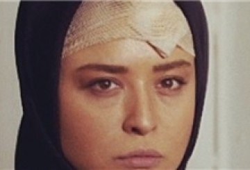 واکنش گریمور 