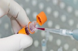 نگهداری بیش از 5 هزار نمونه خون بند ناف
