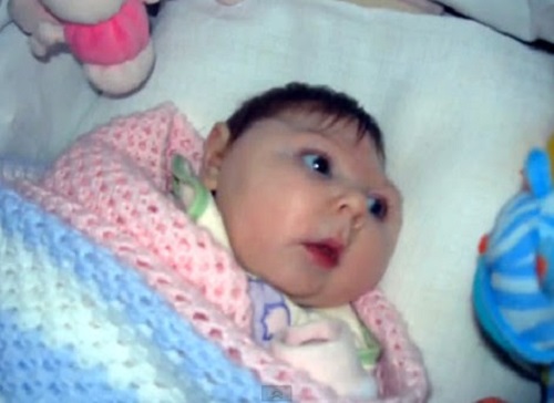 بلایی که 