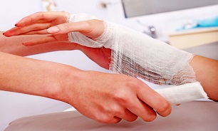 علائم سوختگی را بیشتر بشناسیم علائم سوختگی را بیشتر بشناسیم